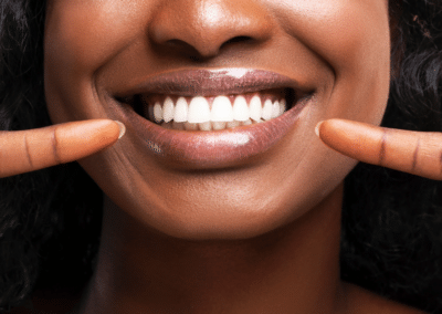 7 Natural Ways to Whiten Teeth
