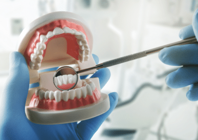 10 Common Dental Issues & Signs of Poor Oral Hygiene