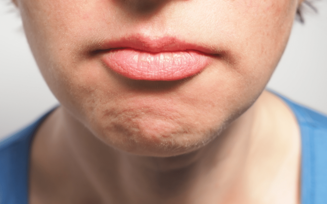 Worst Habits That Damage Oral Health