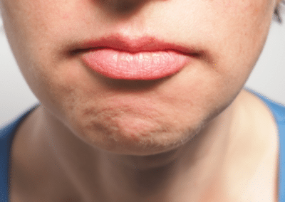 Worst Habits That Damage Oral Health