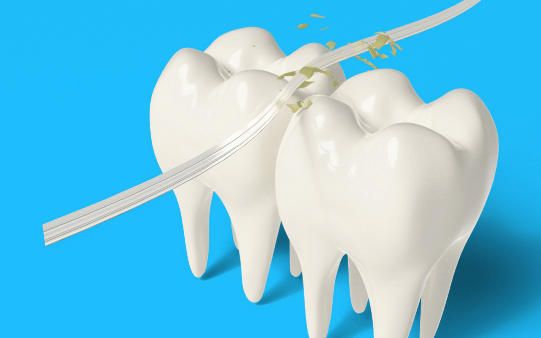 Flossing: A Complete History