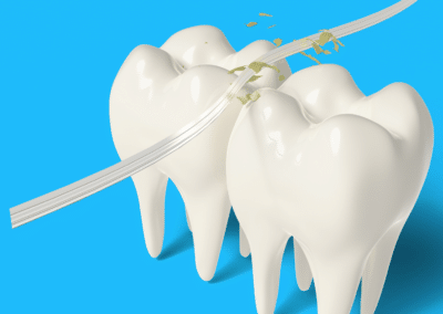 Flossing: A Complete History